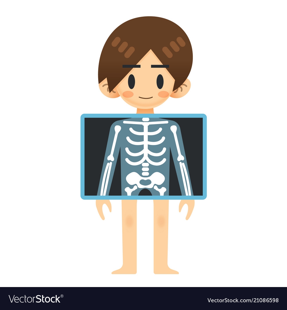 Рентген для детей на прозрачном фоне